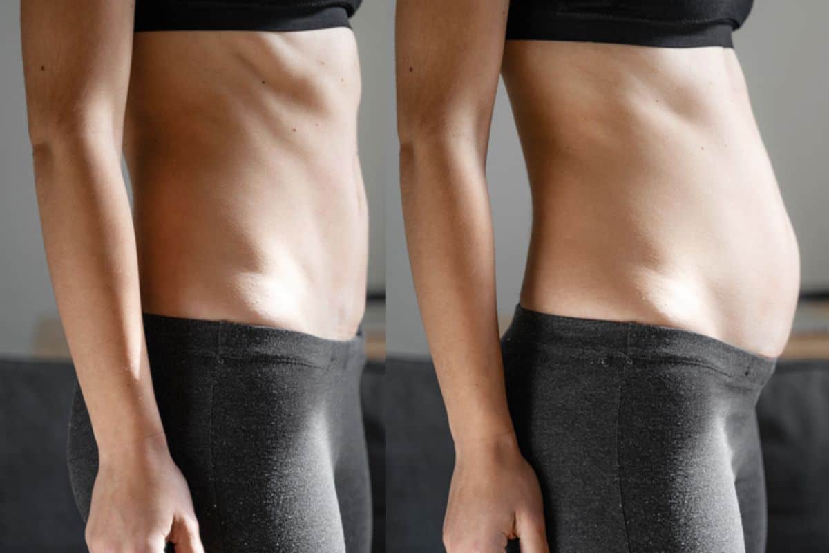 How long does diastasis recti take to improve Ham?