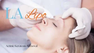 Woman receiving Actinic Keratosis Removal Treatment Ham