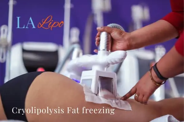 women getting fat freezing Ham