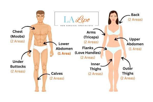 LA LIPO Cryolipolysis Areas Ham