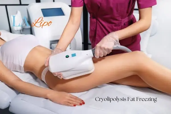 Woman receiving coolsculpting Ham treatment on her thighs