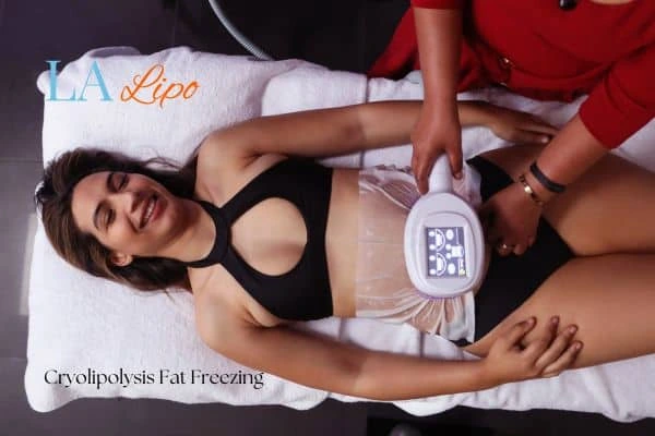 woman getting cryolipolysis Ham