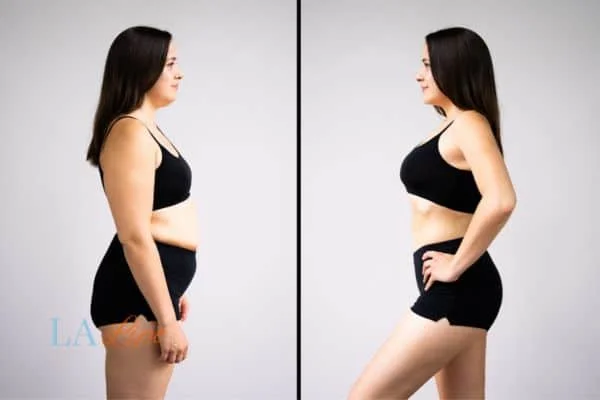 link between body image and mental health Ham