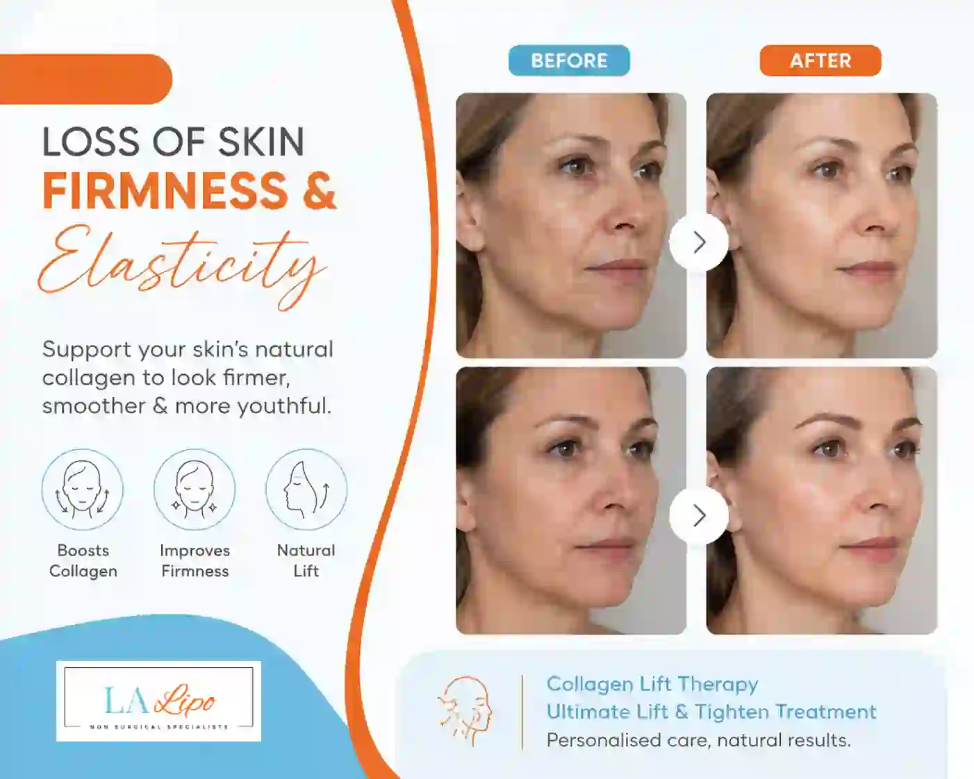 Sign #7: Loss of Skin Firmness and Elasticity Ham